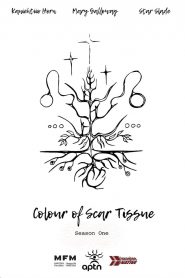 Colour of Scar Tissue